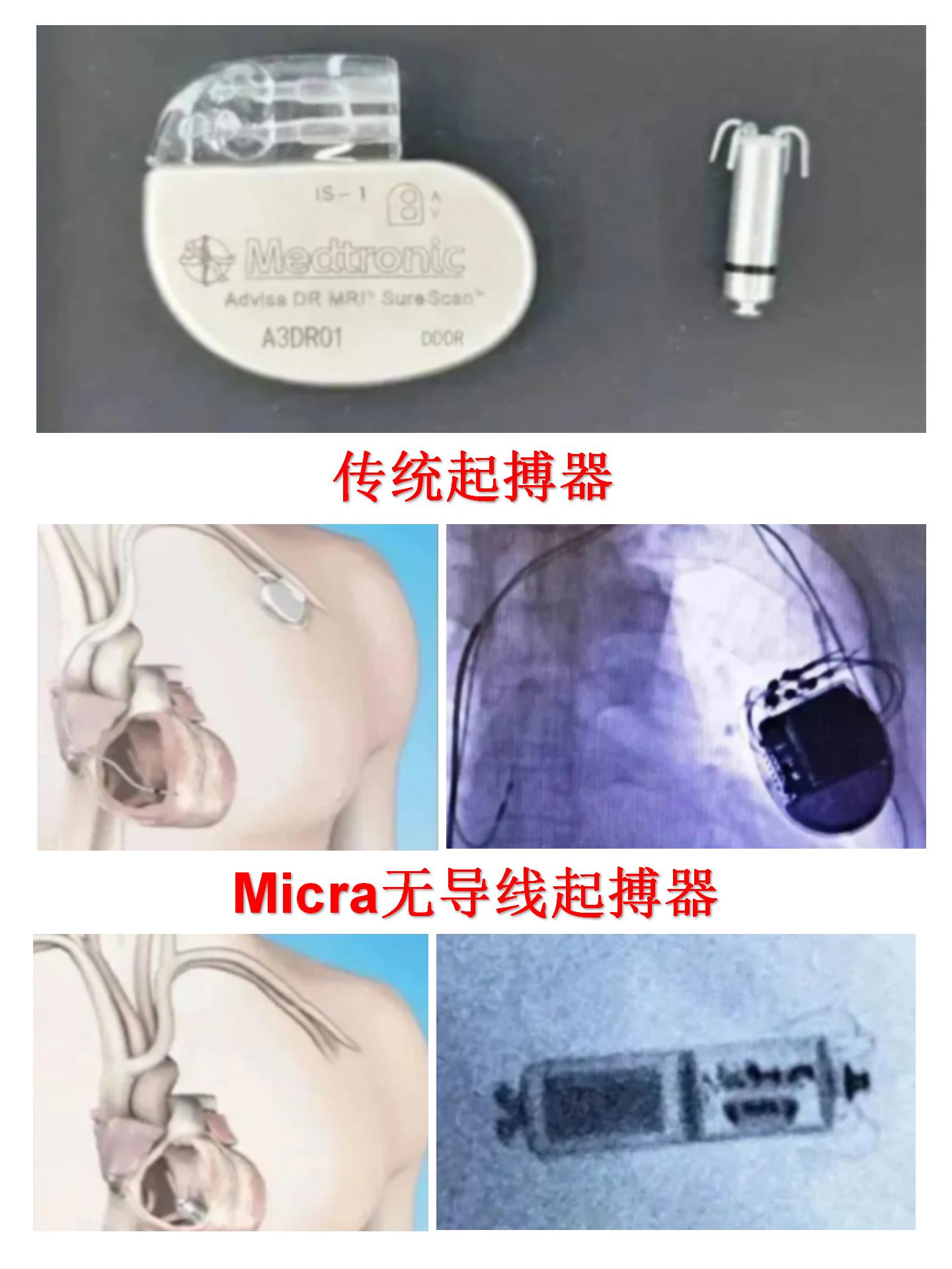 f6568b18aef55d50232af11a4f2baae.jpg