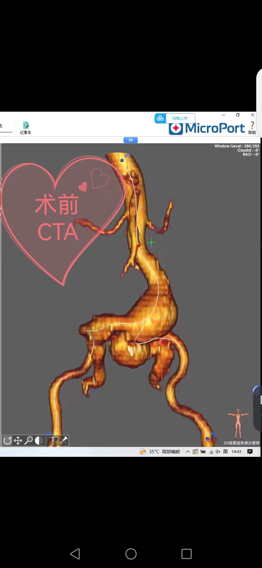 dd0ad44fd66f69d7d1198078b0240031_.jpg
